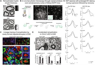 Remyelination in animal models of multiple sclerosis: finding the elusive grail of regeneration